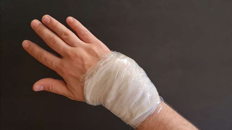 Cataplasma con loys y hojas de col, foto 7